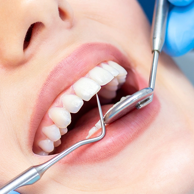 dental crown
