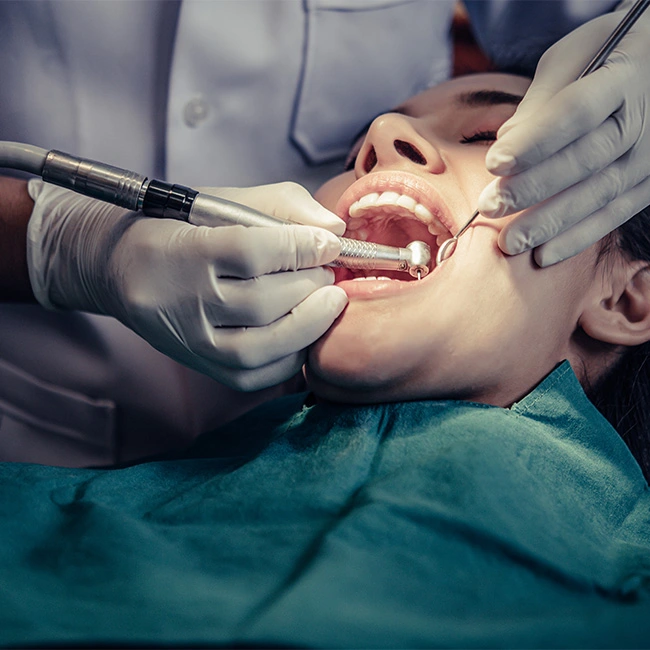 dental filling